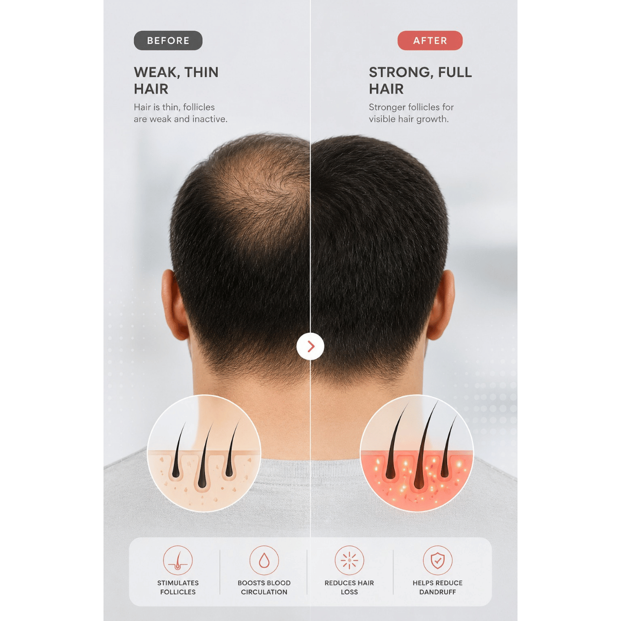 678nm Red Light Hair Growth Helmet