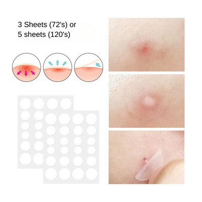 Soul Beauty Fast Acting Hydrocolloid Acne Patch
