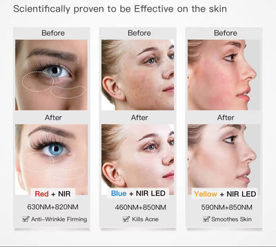Advanced 4-in-1 LED Light Therapy Mask