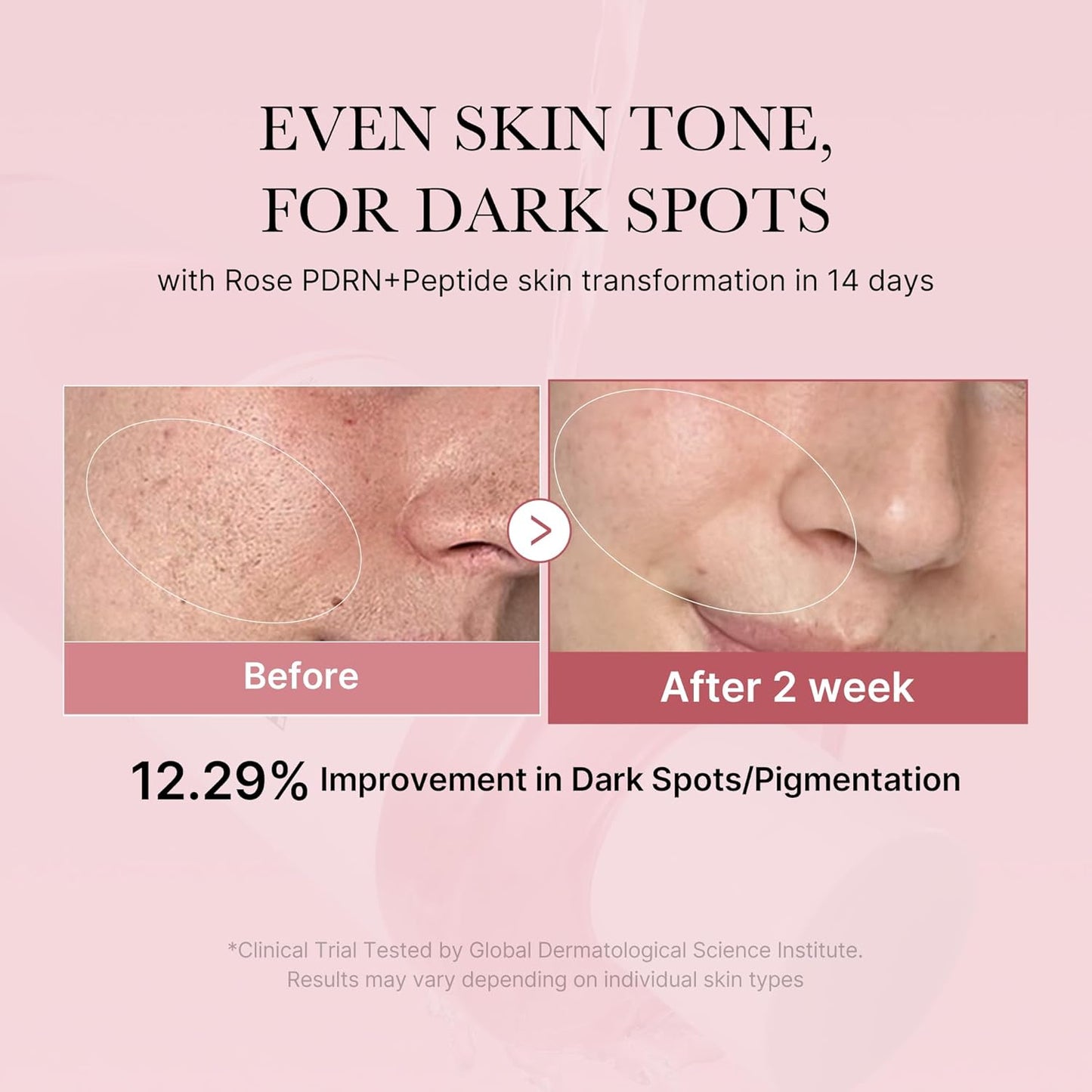 PDRN Pink CICA Soothing Toner